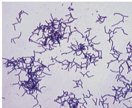 <p>gram (+) bacilli) of actinomyces species</p>