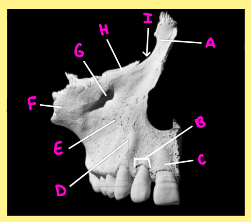 <p><u>Name the following</u>:</p><ul><li><p>Bone?</p></li><li><p>Side?</p></li><li><p>View?</p></li><li><p>E?</p></li></ul><p></p>