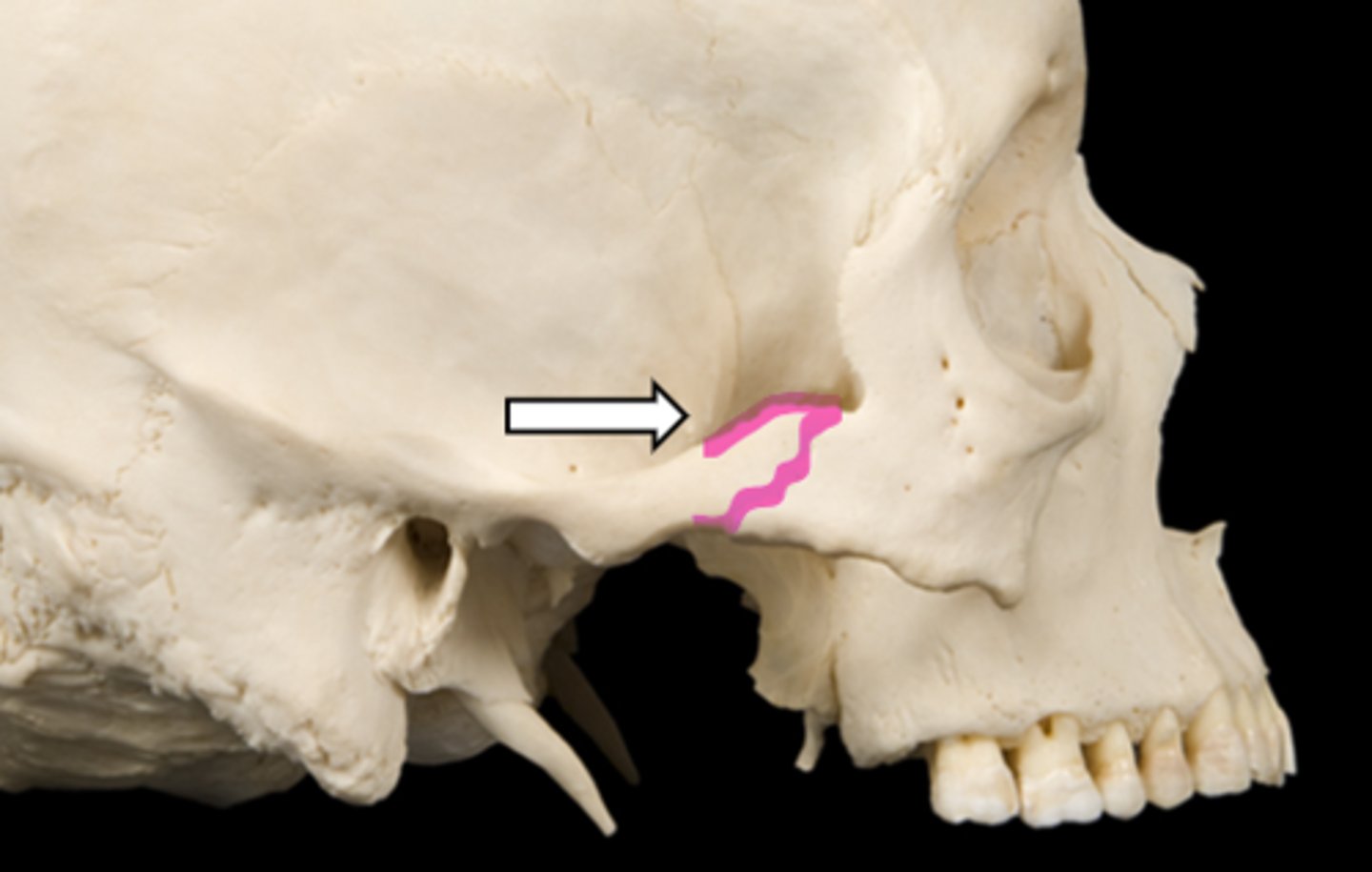 <p>name the part</p>