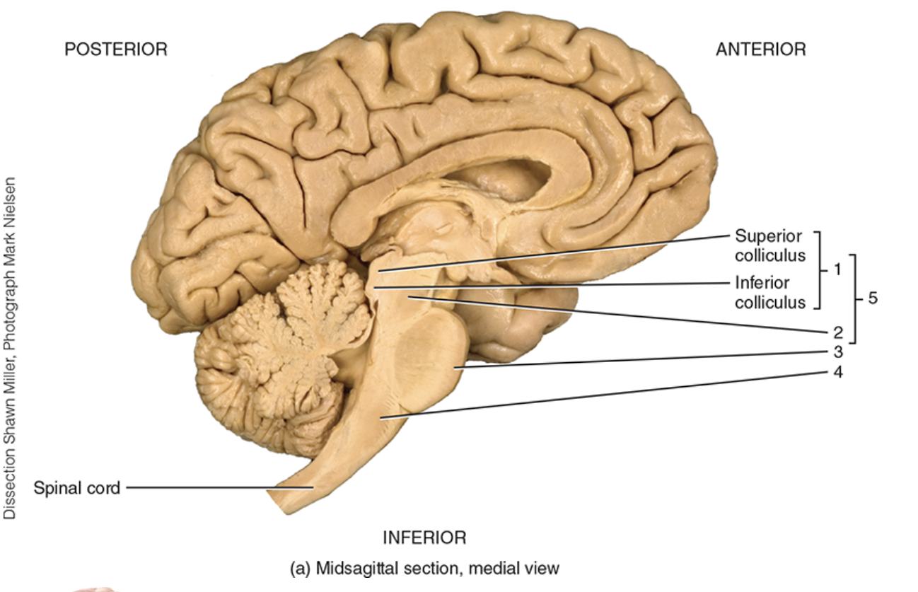 <p>what is label 2 </p>