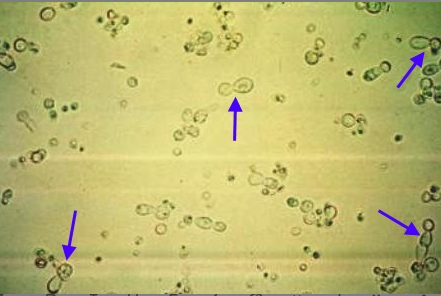 <p>Identify the majority of cells present in this urine slide (arrows indicated)</p>
