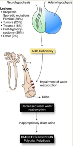 -deficient secretion of arginine vasopressin (AVP) from posterior pituitary