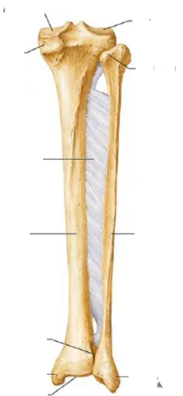 <p>Bone? View? Left or right?</p>