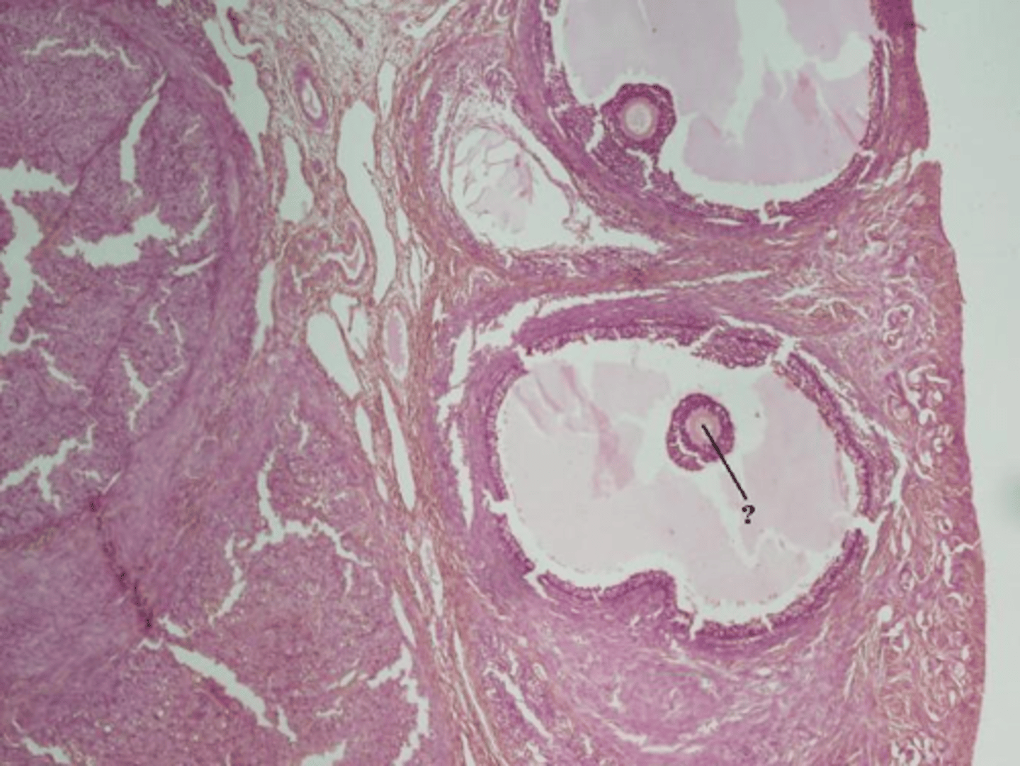 <p>Identify the indicated structure within the ovary.</p>