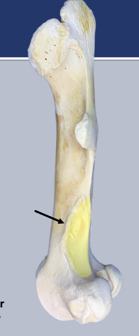 <p>what is the arrow pointing to</p>