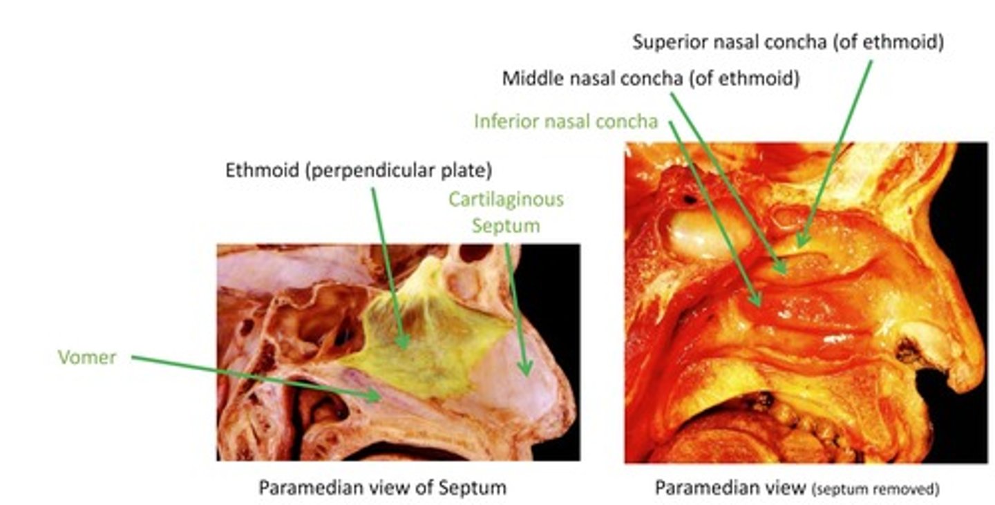 <p>Vomer</p><p>Ethmoid (perpendicular plate)</p><p>Cartilaginous Septum</p><p>Inferior nasal concha</p><p>Middle nasal concha (of ethmoid)</p><p>Superior nasal concha (of ethmoid)</p>