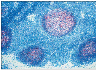 <p>name of histologic slide:</p><p>Stain used:</p>
