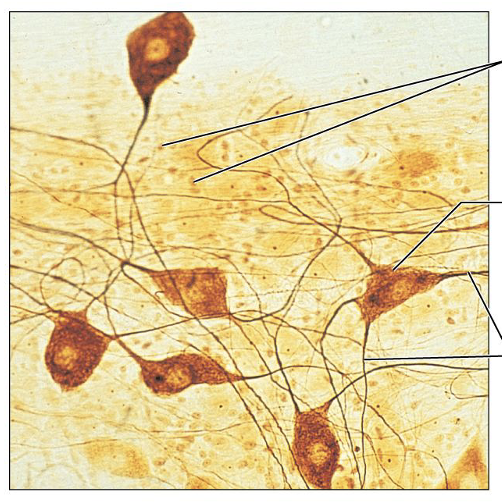 <p>What is this tissue, and where is it found?</p>