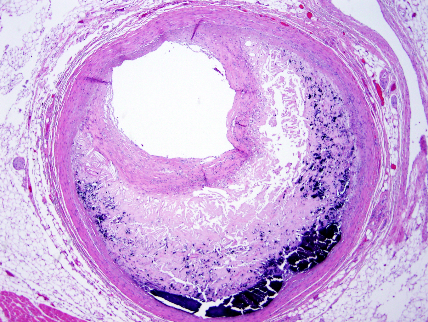 <p>What histological slide is this for?</p>