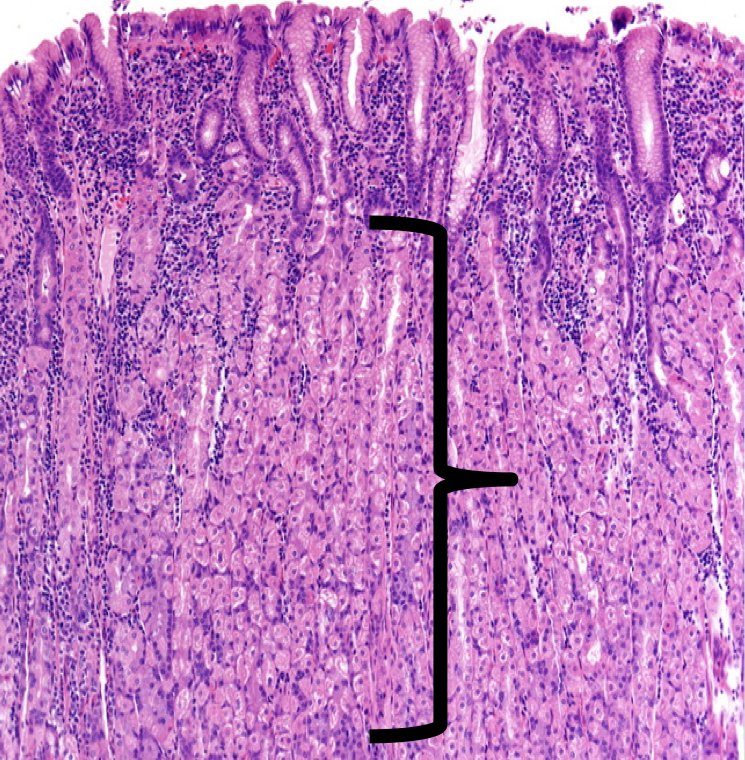 <p>The shown layer produces _______ occupying the entire thickness which opens into the bases of the gastric pits.</p>