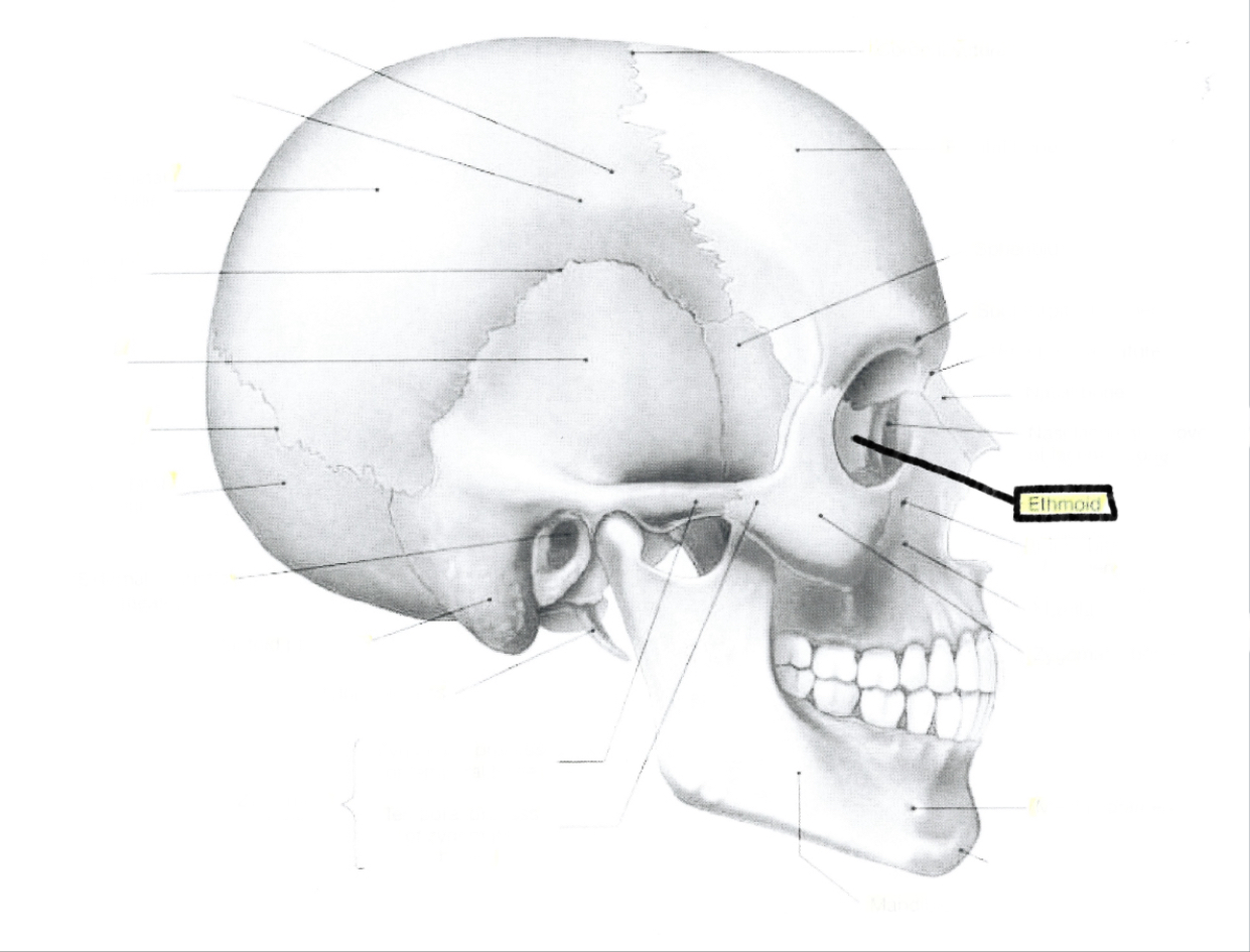 <p>Ethmoid</p>