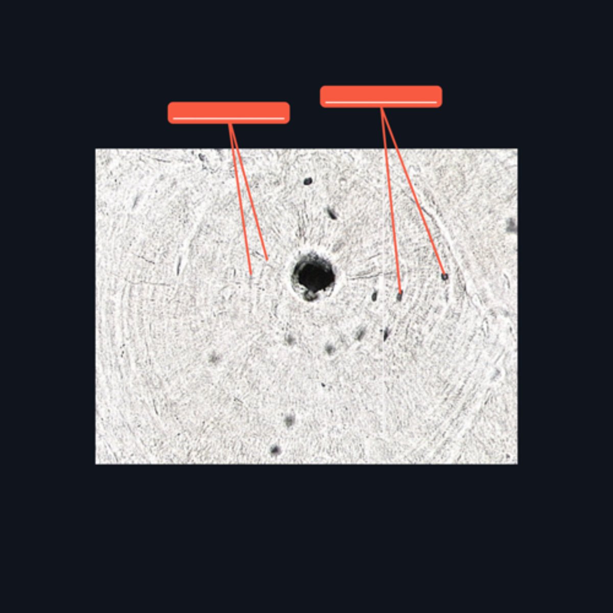<p>These are structures found at the ground bone which are concentrically arranged around the Haversian canal</p>