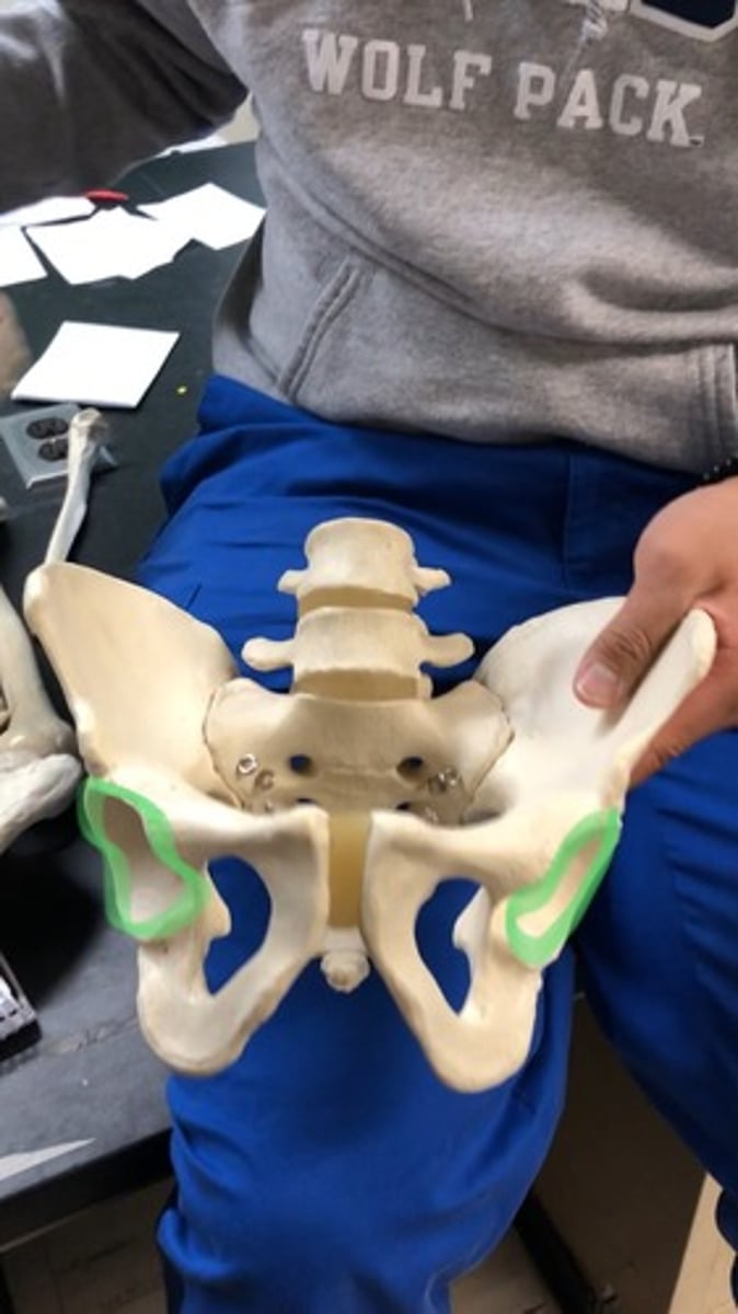 <p>where the femur fits into; hip socket</p>