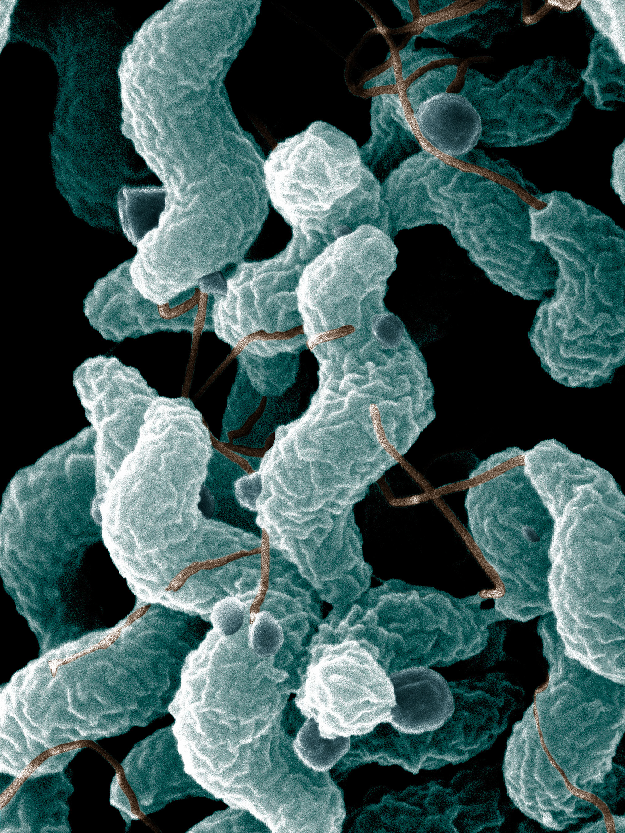 <ul><li><p>Gram-negative, corkscrew-shaped, bipolar flagella. </p></li></ul><ul><li><p>Causes Campylobacter enterocolitis.</p></li></ul><p></p>