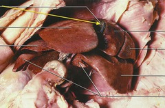 <p>stores and concentrates bile</p>