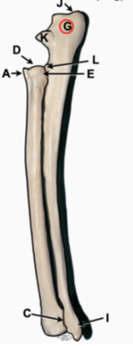 <p>proximal aspect of ulna, point of elbow</p>