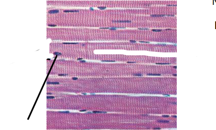 <p>What type of skeletal muscle tissue is this?</p>