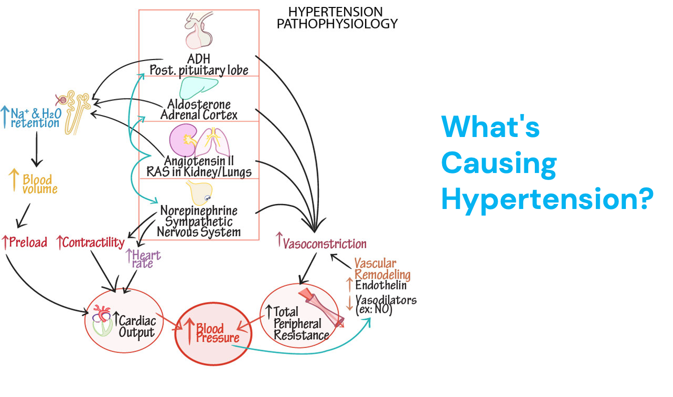 <p>Pathophysiology of <strong>HTN</strong> </p>