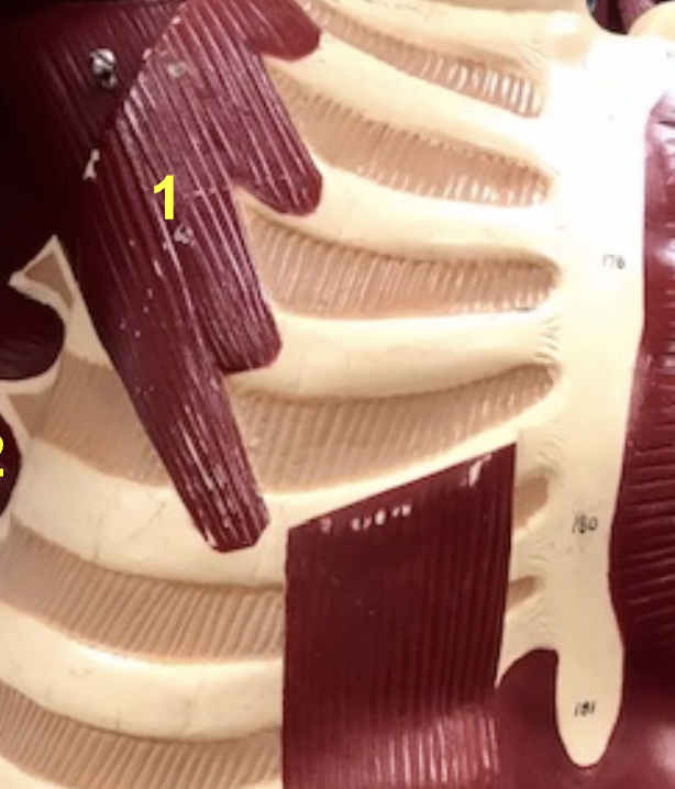 <p>Pectoralis Minor </p>