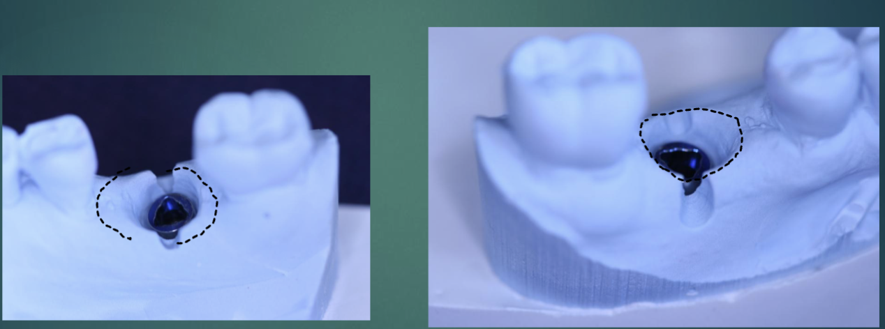 <p>buccal/lingual </p>