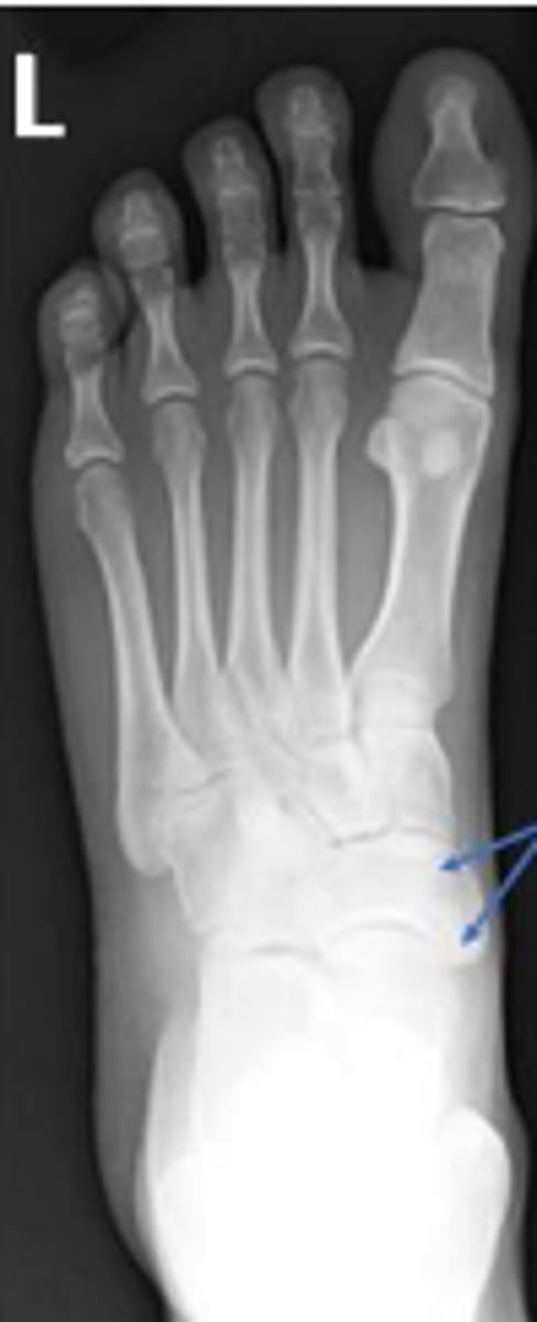 <p>What are the arrows pointing to?</p>