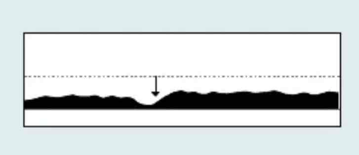 <p>which Capnography waveform is this</p>