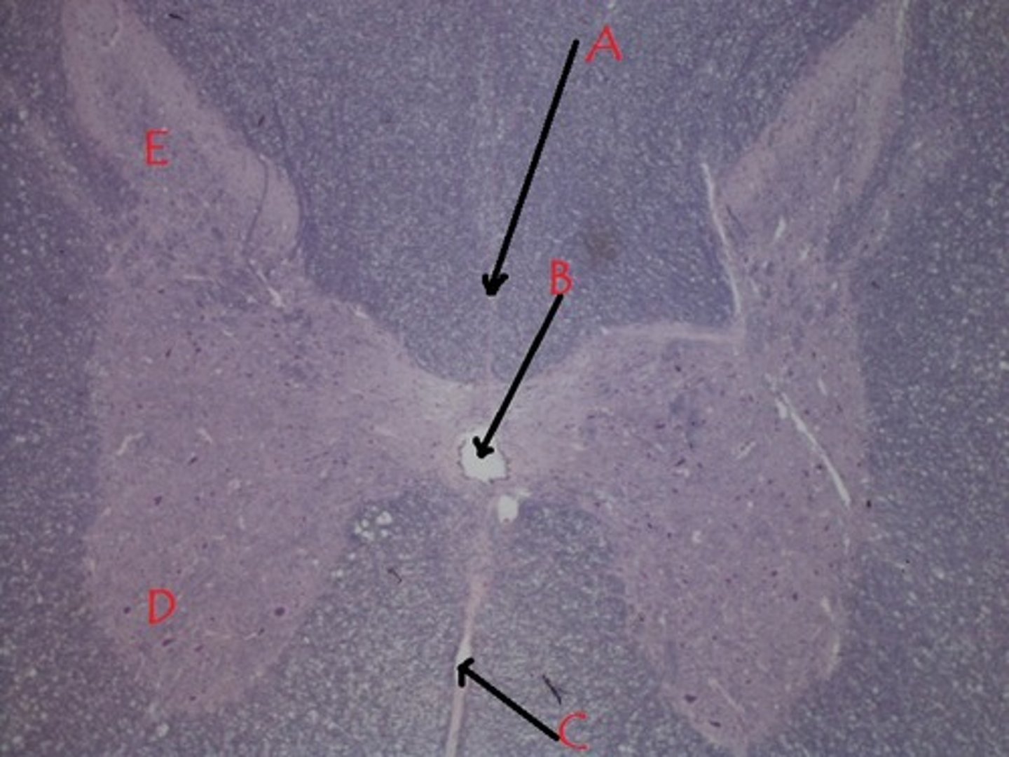 <p>E</p>