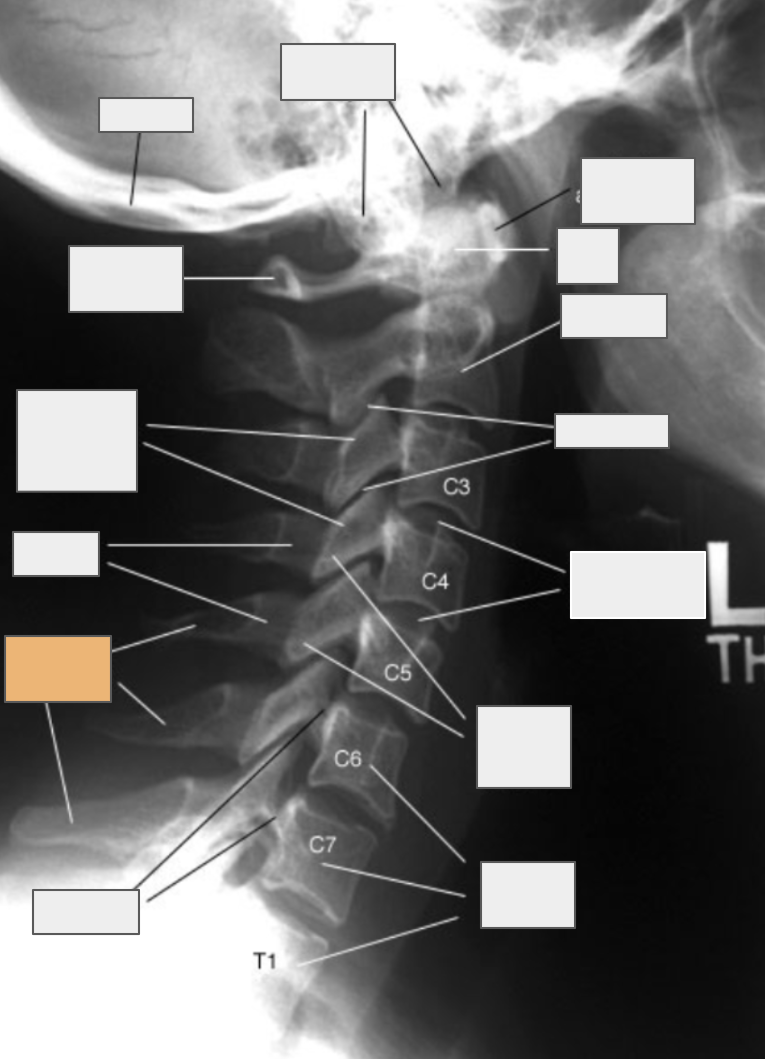 <p>What structure of the spine does the box highlighted in orange reference to?</p>