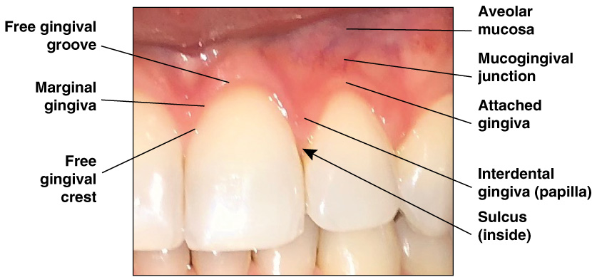 <p>The peak of the free gingiva </p>