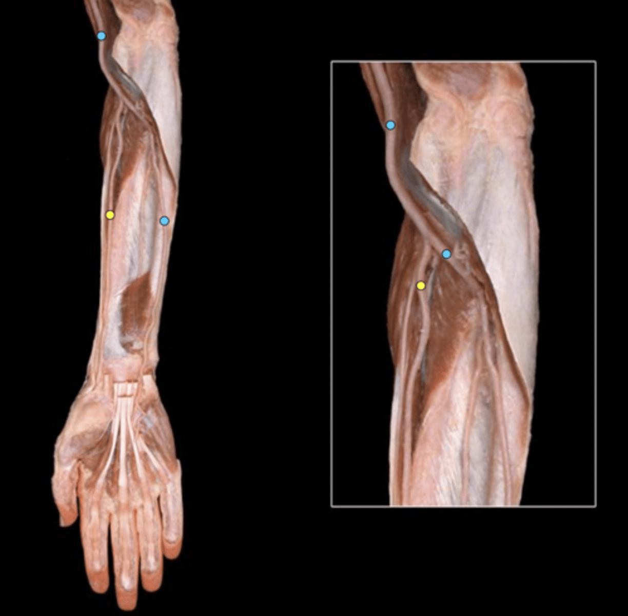 knowt flashcard image