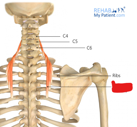<p>Origin: Ribs 3-6</p><p>Insertion: Transverse processes of vertebrae C04-C06</p><p>Innervation: Dorsal rami of the spinal nerves</p><p>Action: Extension and lateral flexion of the spine</p>