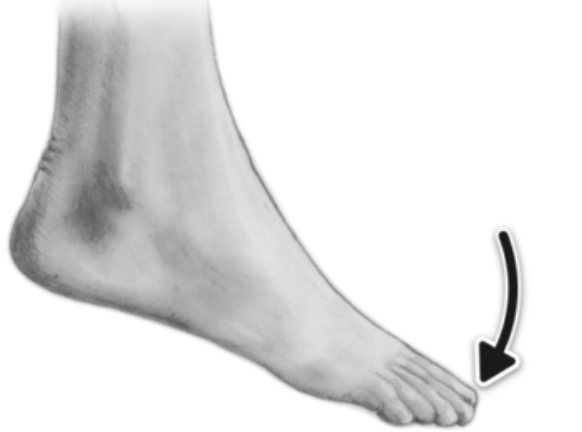 <p>What type of joint movement is this?</p>