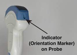 Describes the orientation index image marker on all ultrasound transducers.