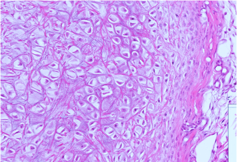 <p>Which cartilage is shown in the following image?</p>