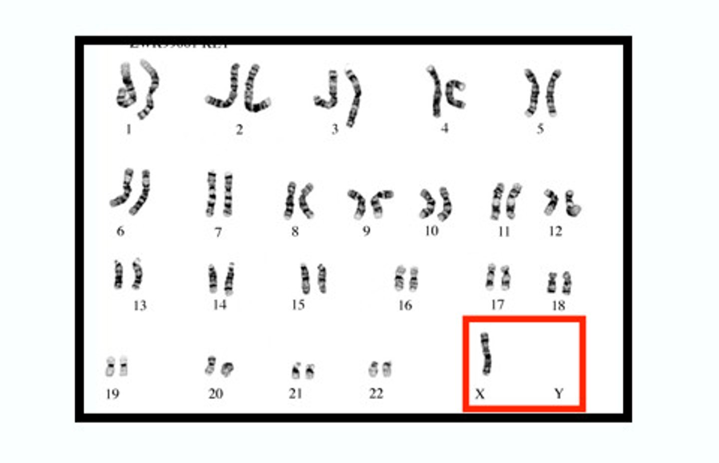 <p>missing a chromosome</p>