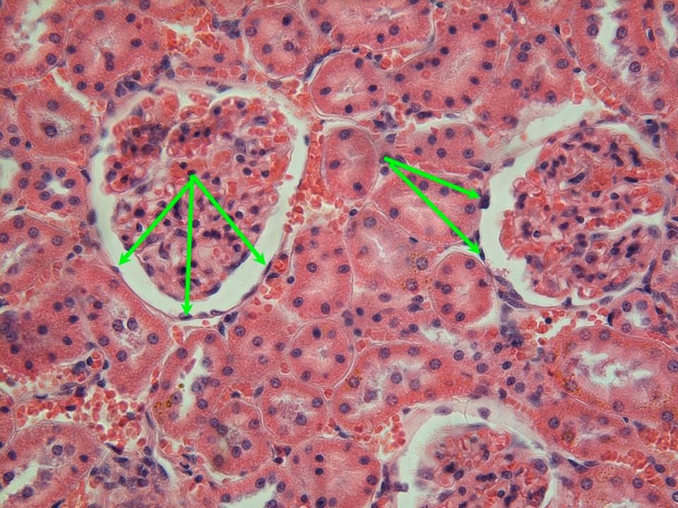 <p>Simple Squamous Epithelium</p>