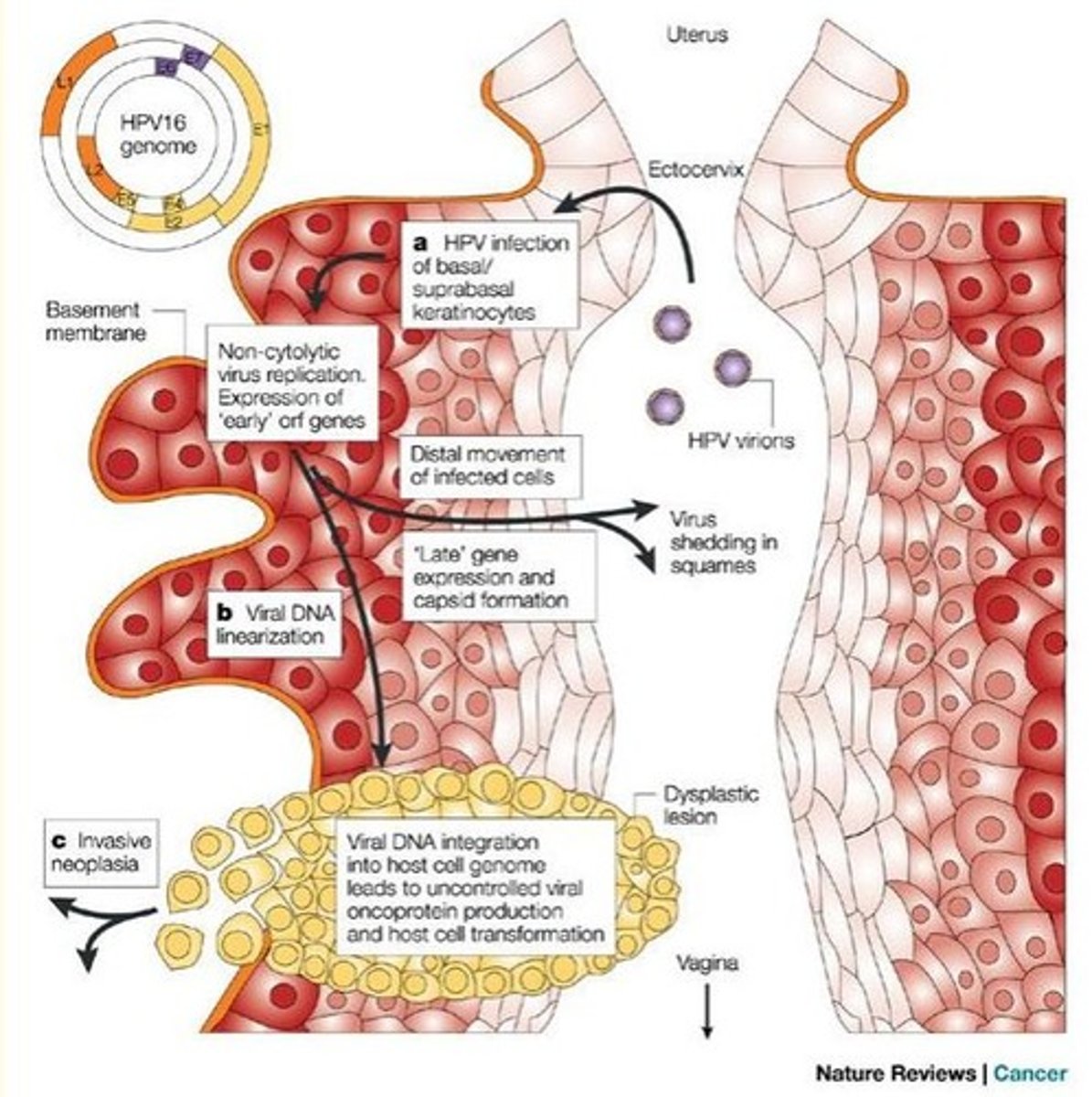 <p>The ‘hijacking’ of the human cell to produce viral E6 and E7 proteins can trigger cancer, especially if the host already has Herpes virus.</p><p>- E6 gene product binds to human p53 tumor suppressor protein to impede cell growth</p><p>- E7 anti-apoptotic effect through mutations in p53 protein</p><p>- Unregulated, unimpeded cell growth (cancer transformation)</p>