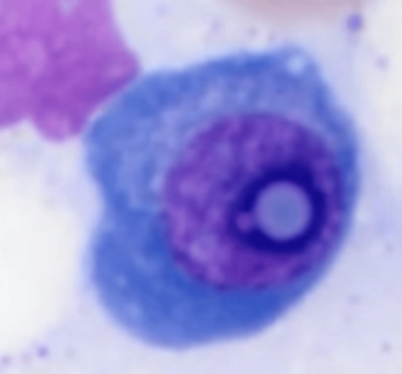 <p>Plasma cell inclusion</p><p>Intranuclear inclusions that can easily be mistaken for nucleoli</p>