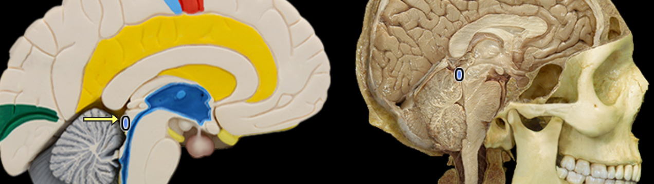 <p>Inferior colliculus</p>