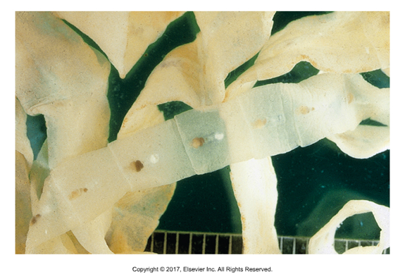 <ul><li><p>Look similar to true tapeworms but have centrally located reproductive organs​</p></li><li><p>Unembryonated operculated eggs (almost identical to trematodes)​</p></li><li><p>Most release eggs directly from uterus passed in feces of definitive host​</p></li><li><p>Sometimes short chains of proglottids are released​</p></li><li><p>No acetabula or rostellum but two slitlike organs called bothria</p></li></ul><p></p>