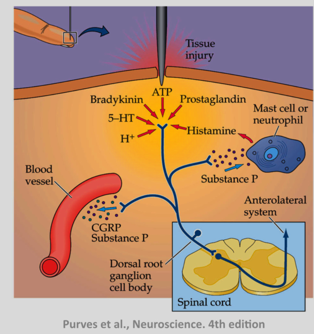 <p><span>The inflammatory soup: cytokines, prostaglandins, bradykinin, ATP, and other mediators maintain depolarisation and sensitization of C-fibre terminals.</span></p><p class="p1"><span>This leads to:</span></p><p class="p2"><span>•	Hyperalgesia: increased pain to normally painful stimuli</span></p><p class="p2"><span>•	Allodynia: pain from normally non-painful stimuli</span></p><p class="p1"></p><p class="p1"><span>Inflammation reduces the threshold of nociceptors, so they fire more easily. This is why injured skin becomes more sensitive.</span></p>
