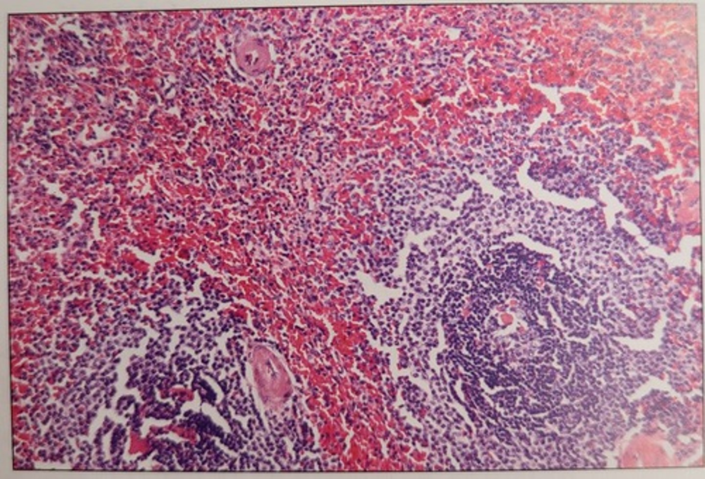 <p>c. spleen</p><p>- The tissue shown in this image is spleen.</p>