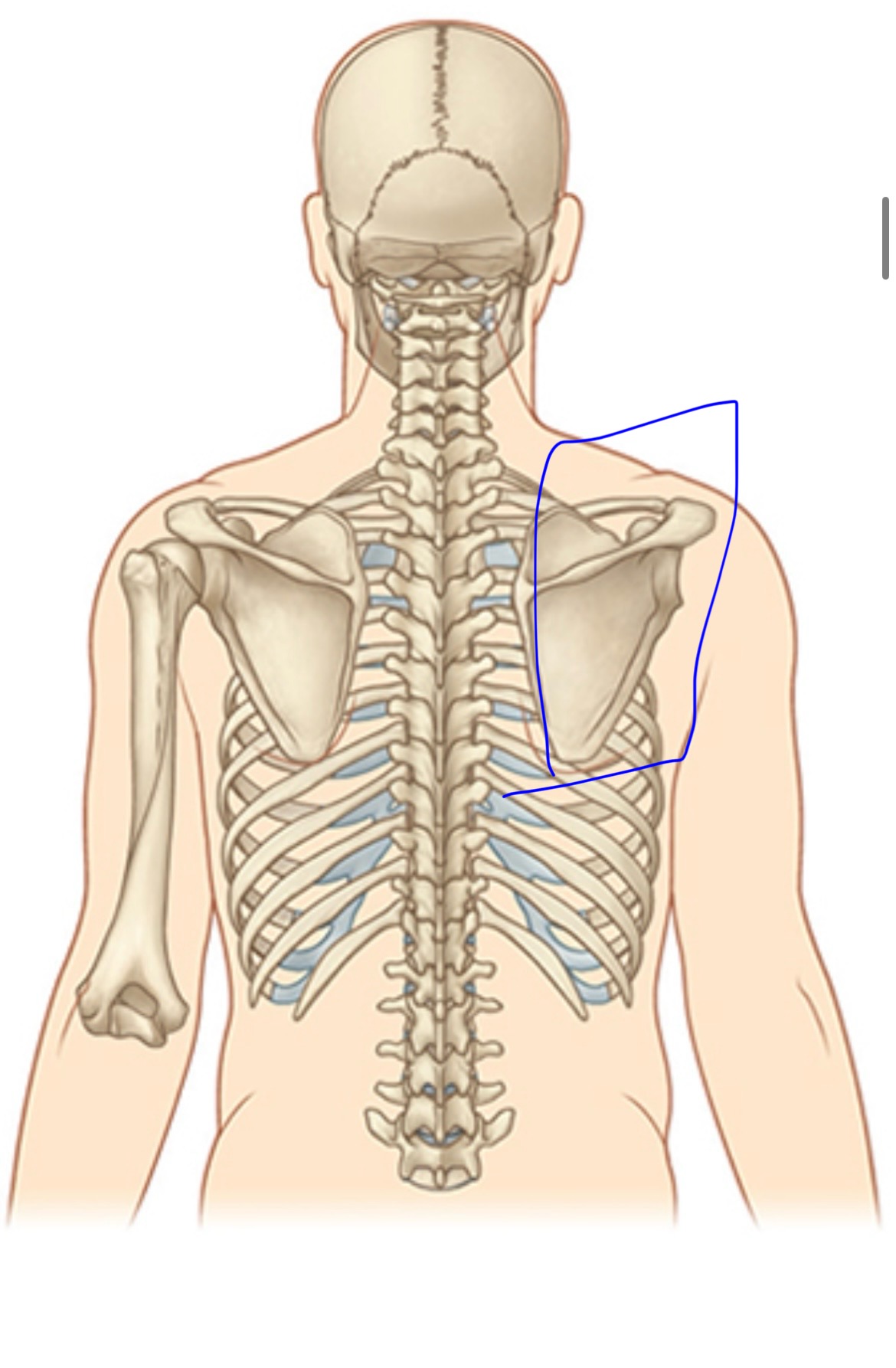 term image