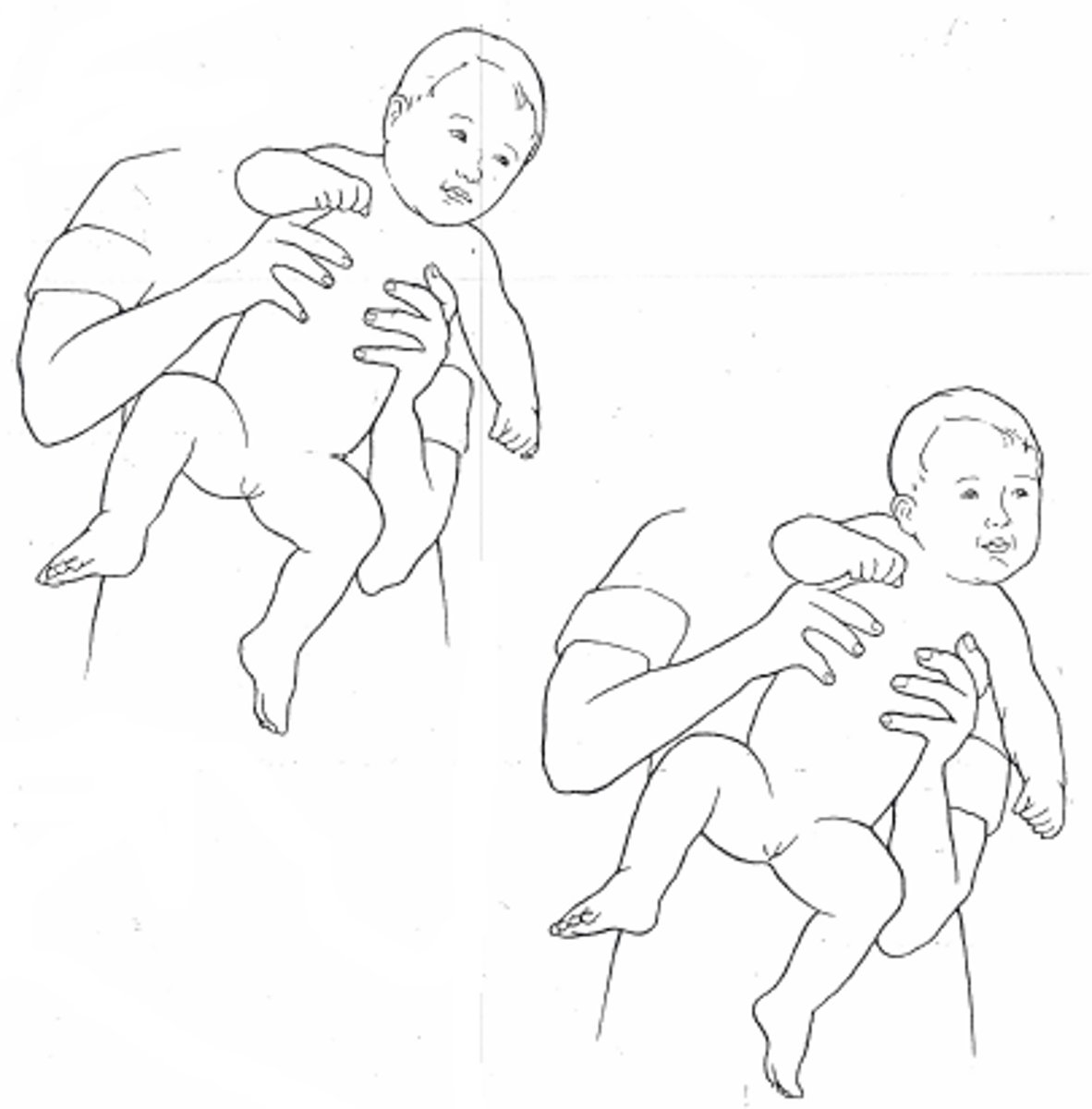 <p>same as labyrinthine without eyes covered</p>