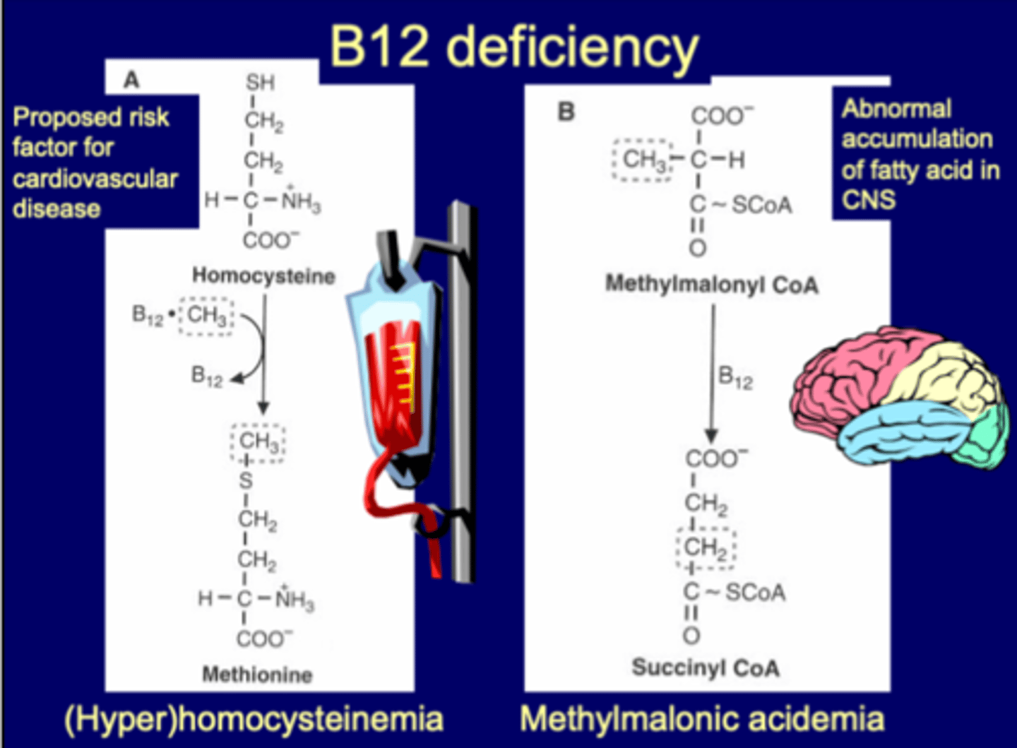 <p>risk factor for cardiovascular disease</p><p>-(hyper)homocysteinemia</p><p></p><p>abnormal accumulation of FA in CNS</p><p>-leads to accumulation of methylmalonyl CoA (methylmalonic acidemia- MMA)</p><p>-<strong>MMA up specific to B12 (NOT FOLIC ACID)</strong></p><p>-acidemia is the condition of high MMA (also called MMA)</p><p>-if MMA going up, pathway is blocked, FA not degrading, accumulate in body->typically in brain or CNS</p>