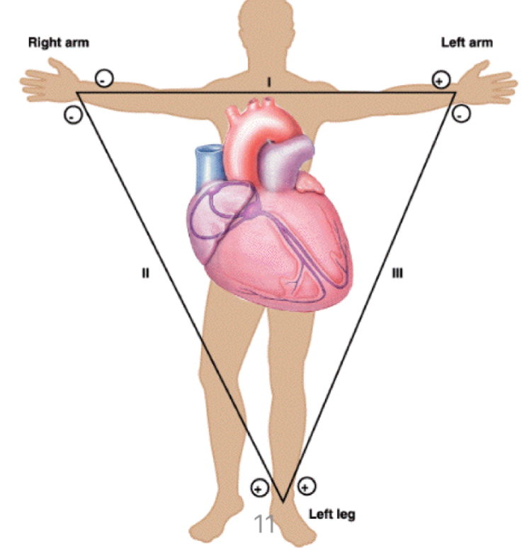<p>Measures from left arm to left leg</p>