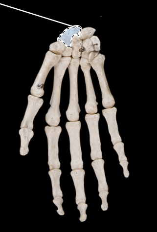 <p>Bones of the hand, anterior view, right side</p>