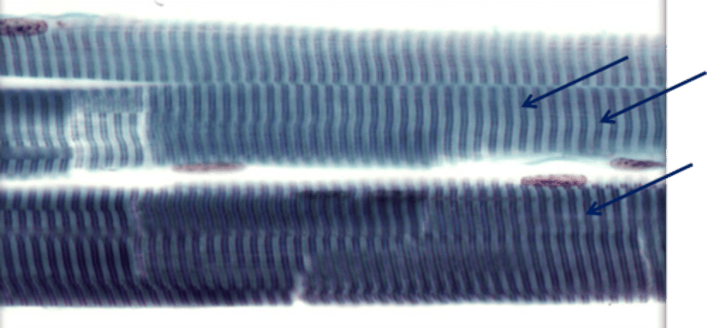 <p>What are these lines called?</p>