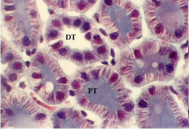 <p>Proximal tubules have villi while distal tubules don’t.</p>