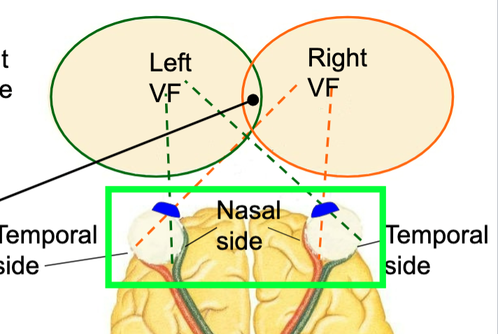 <p>the part of the enviornment that is registered on the retina </p><p>L and R fields overlap = binocular field </p><p>if object is on non-overlapping side of L VF= left eye image will form on nasal side and R eye image will form on temporal side </p><p></p><p>if object is on non-overlapping side of R VF= left eye image will form on temporal side and R eye image will form on nasal side</p><p>optic tracts carry info to thalamus→ <strong>lateral geniculate nuclei</strong>→ primary visual cortex</p>